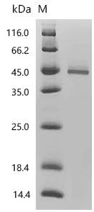 (Tris-Glycine gel) Discontinuous SDS-PAGE (reduced) with 5% enrichment gel and 15% separation gel.