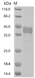 (Tris-Glycine gel) Discontinuous SDS-PAGE (reduced) with 5% enrichment gel and 15% separation gel.