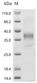 (Tris-Glycine gel) Discontinuous SDS-PAGE (reduced) with 5% enrichment gel and 15% separation gel.