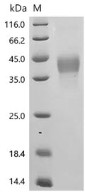 (Tris-Glycine gel) Discontinuous SDS-PAGE (reduced) with 5% enrichment gel and 15% separation gel.