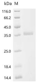 (Tris-Glycine gel) Discontinuous SDS-PAGE (reduced) with 5% enrichment gel and 15% separation gel.