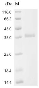 (Tris-Glycine gel) Discontinuous SDS-PAGE (reduced) with 5% enrichment gel and 15% separation gel.