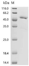 (Tris-Glycine gel) Discontinuous SDS-PAGE (reduced) with 5% enrichment gel and 15% separation gel.