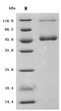 (Tris-Glycine gel) Discontinuous SDS-PAGE (reduced) with 5% enrichment gel and 15% separation gel.
