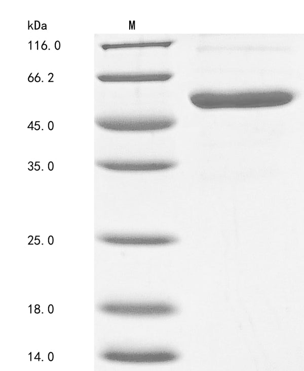 (Tris-Glycine gel) Discontinuous SDS-PAGE (reduced) with 5% enrichment gel and 15% separation gel.