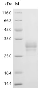 (Tris-Glycine gel) Discontinuous SDS-PAGE (reduced) with 5% enrichment gel and 15% separation gel.