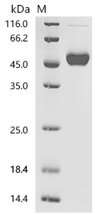 (Tris-Glycine gel) Discontinuous SDS-PAGE (reduced) with 5% enrichment gel and 15% separation gel.
