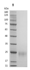 Recombinant Human Vascular endothelial growth factor A, long form (VEGFA) (Active) – Figure 1 of 1