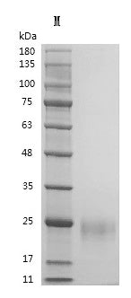 Recombinant Human Vascular endothelial growth factor A, long form (VEGFA) (Active) – Figure 1 of 1
