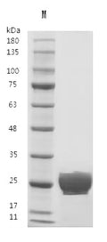 Recombinant Human Vascular endothelial growth factor A, long form (VEGFA) (Active) – Figure 1 of 1