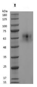 Recombinant Human Vitronectin (VTN) (Active) – Figure 1 of 1