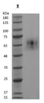 Recombinant Human Vitronectin (VTN) (Active) – Figure 1 of 1