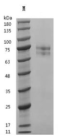 Recombinant Human Vitronectin (VTN) (Active) – Figure 1 of 1