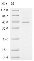 (Tris-Glycine gel) Discontinuous SDS-PAGE (reduced) with 5% enrichment gel and 15% separation gel.