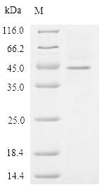 (Tris-Glycine gel) Discontinuous SDS-PAGE (reduced) with 5% enrichment gel and 15% separation gel.