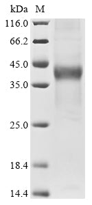 (Tris-Glycine gel) Discontinuous SDS-PAGE (reduced) with 5% enrichment gel and 15% separation gel.