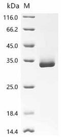 (Tris-Glycine gel) Discontinuous SDS-PAGE (reduced) with 5% enrichment gel and 15% separation gel.