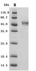 (Tris-Glycine gel) Discontinuous SDS-PAGE (reduced) with 5% enrichment gel and 15% separation gel.