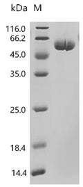 (Tris-Glycine gel) Discontinuous SDS-PAGE (reduced) with 5% enrichment gel and 15% separation gel.