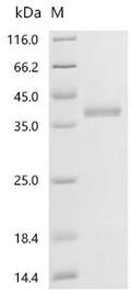 (Tris-Glycine gel) Discontinuous SDS-PAGE (reduced) with 5% enrichment gel and 15% separation gel.
