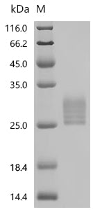 (Tris-Glycine gel) Discontinuous SDS-PAGE (reduced) with 5% enrichment gel and 15% separation gel.