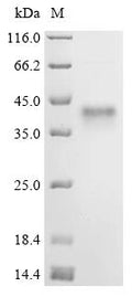(Tris-Glycine gel) Discontinuous SDS-PAGE (reduced) with 5% enrichment gel and 15% separation gel.