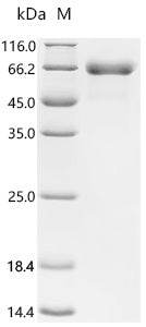 (Tris-Glycine gel) Discontinuous SDS-PAGE (reduced) with 5% enrichment gel and 15% separation gel.