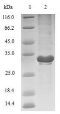 (Tris-Glycine gel) Discontinuous SDS-PAGE (reduced) with 5% enrichment gel and 15% separation gel.