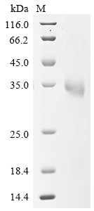 (Tris-Glycine gel) Discontinuous SDS-PAGE (reduced) with 5% enrichment gel and 15% separation gel.