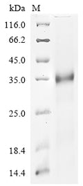 (Tris-Glycine gel) Discontinuous SDS-PAGE (reduced) with 5% enrichment gel and 15% separation gel.