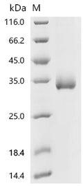 (Tris-Glycine gel) Discontinuous SDS-PAGE (reduced) with 5% enrichment gel and 15% separation gel.