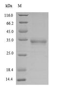 (Tris-Glycine gel) Discontinuous SDS-PAGE (reduced) with 5% enrichment gel and 15% separation gel.