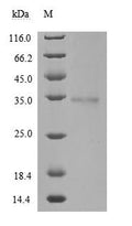 (Tris-Glycine gel) Discontinuous SDS-PAGE (reduced) with 5% enrichment gel and 15% separation gel.