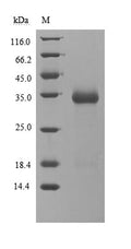 (Tris-Glycine gel) Discontinuous SDS-PAGE (reduced) with 5% enrichment gel and 15% separation gel.