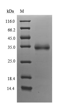 (Tris-Glycine gel) Discontinuous SDS-PAGE (reduced) with 5% enrichment gel and 15% separation gel.