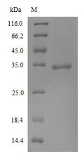 (Tris-Glycine gel) Discontinuous SDS-PAGE (reduced) with 5% enrichment gel and 15% separation gel.