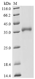 (Tris-Glycine gel) Discontinuous SDS-PAGE (reduced) with 5% enrichment gel and 15% separation gel.
