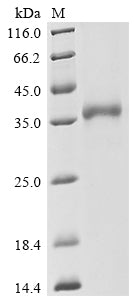 (Tris-Glycine gel) Discontinuous SDS-PAGE (reduced) with 5% enrichment gel and 15% separation gel.