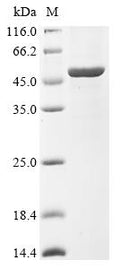 (Tris-Glycine gel) Discontinuous SDS-PAGE (reduced) with 5% enrichment gel and 15% separation gel.
