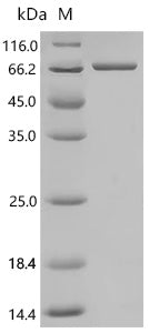 Recombinant Arachis hypogaea Allergen Ara h 1, clone P41B, partial – Figure 1 of 1