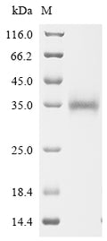 (Tris-Glycine gel) Discontinuous SDS-PAGE (reduced) with 5% enrichment gel and 15% separation gel.
