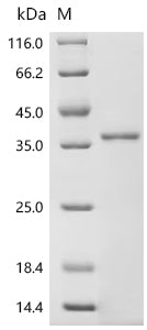 (Tris-Glycine gel) Discontinuous SDS-PAGE (reduced) with 5% enrichment gel and 15% separation gel.