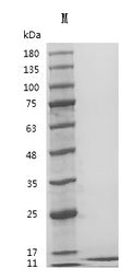 Recombinant Human Insulin-like growth factor I (IGF1) (E51R) (Active) – Figure 1 of 1