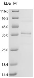 (Tris-Glycine gel) Discontinuous SDS-PAGE (reduced) with 5% enrichment gel and 15% separation gel.