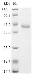 (Tris-Glycine gel) Discontinuous SDS-PAGE (reduced) with 5% enrichment gel and 15% separation gel.