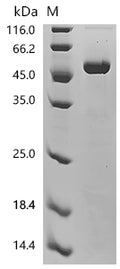 (Tris-Glycine gel) Discontinuous SDS-PAGE (reduced) with 5% enrichment gel and 15% separation gel.
