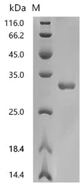 (Tris-Glycine gel) Discontinuous SDS-PAGE (reduced) with 5% enrichment gel and 15% separation gel.