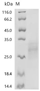 (Tris-Glycine gel) Discontinuous SDS-PAGE (reduced) with 5% enrichment gel and 15% separation gel.