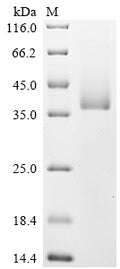 (Tris-Glycine gel) Discontinuous SDS-PAGE (reduced) with 5% enrichment gel and 15% separation gel.