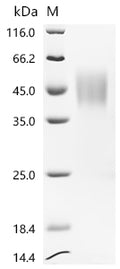 (Tris-Glycine gel) Discontinuous SDS-PAGE (reduced) with 5% enrichment gel and 15% separation gel.